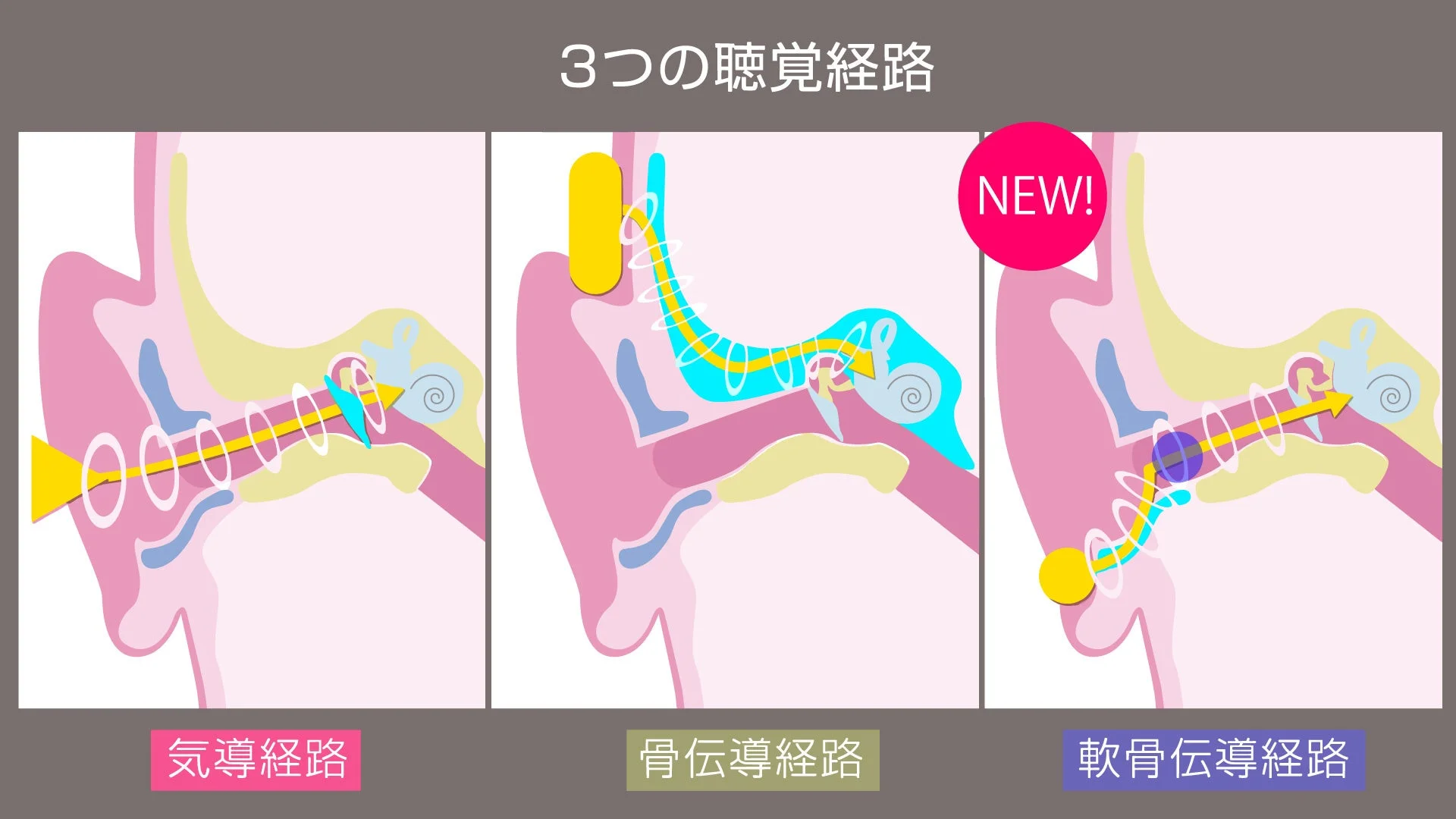 人間の耳における3つの異なる聴覚経路を図解