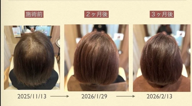 育毛ソリューションの改善例