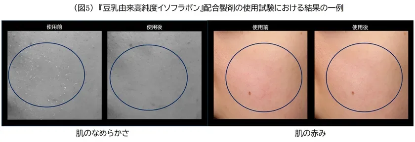 豆乳由来高純度イソフラボン配合製剤の使用試験における結果の一例