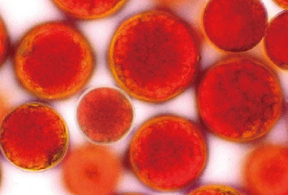 顕微鏡で捉えられた、赤く丸い細胞または微細な粒子の集合体
